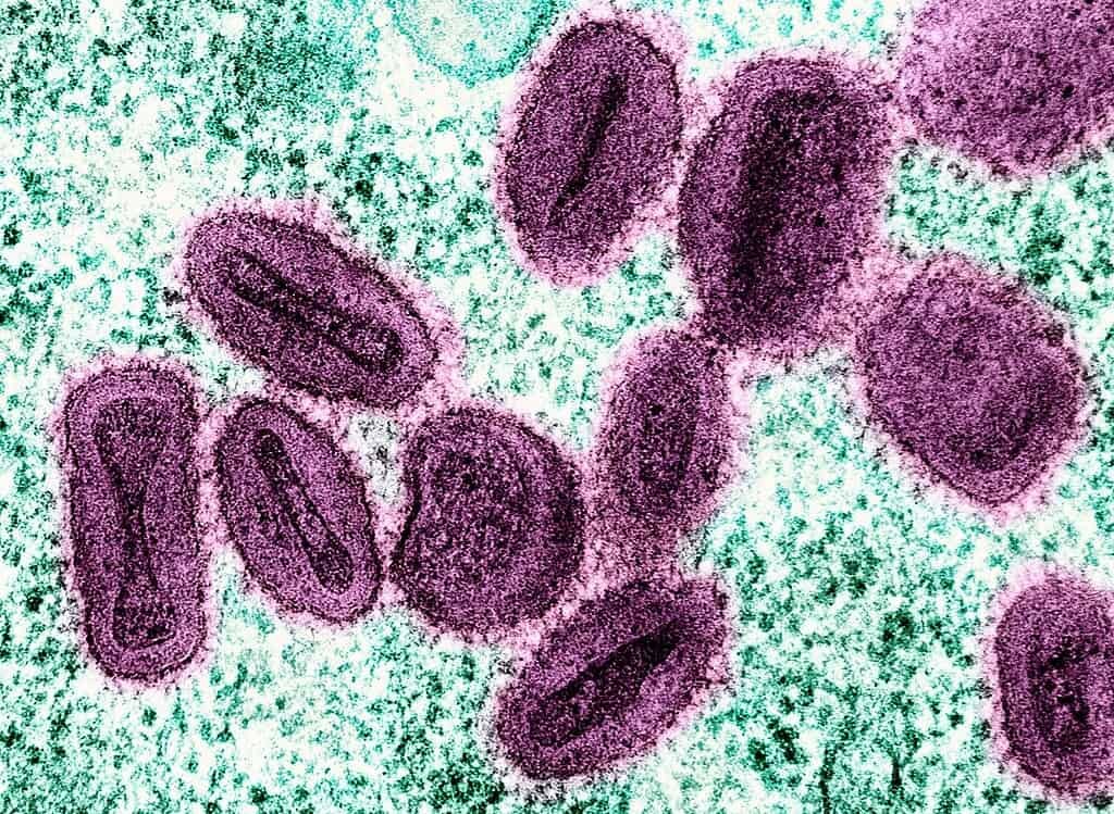 Mpox Keeps Coming Back and Scientists Are Starting to Understand Why | Philly PI